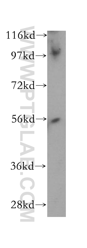 14767-1-AP;Jurkat cells