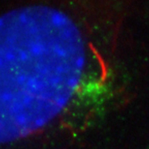 20229-1-AP;IMCD3 cells