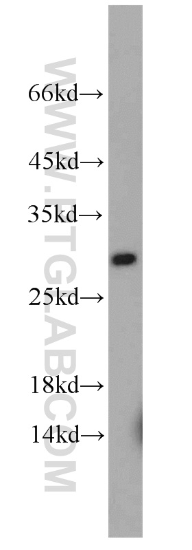 10788-1-AP;mouse lung tissue