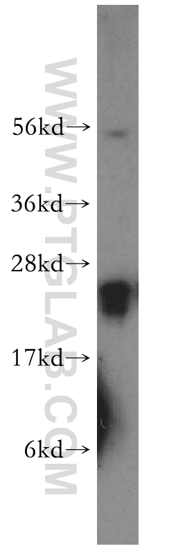 16867-1-AP;human brain tissue