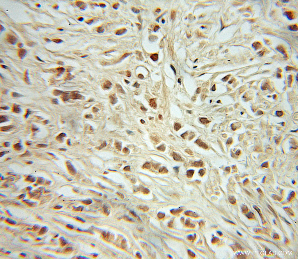 10048-2-Ig;human prostate cancer