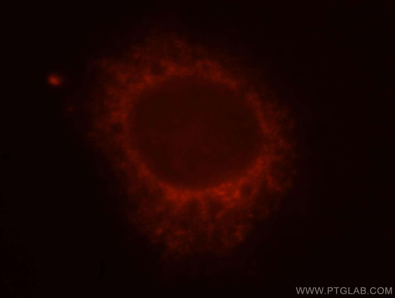 10073-1-AP;MCF-7