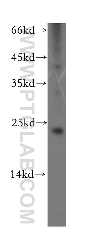 10073-1-AP;mouse eye tissue