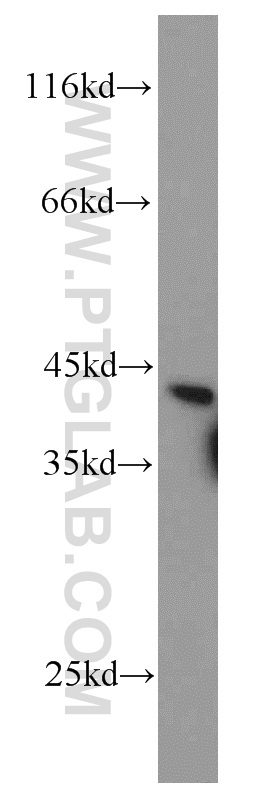 14644-1-AP;human kidney tissue