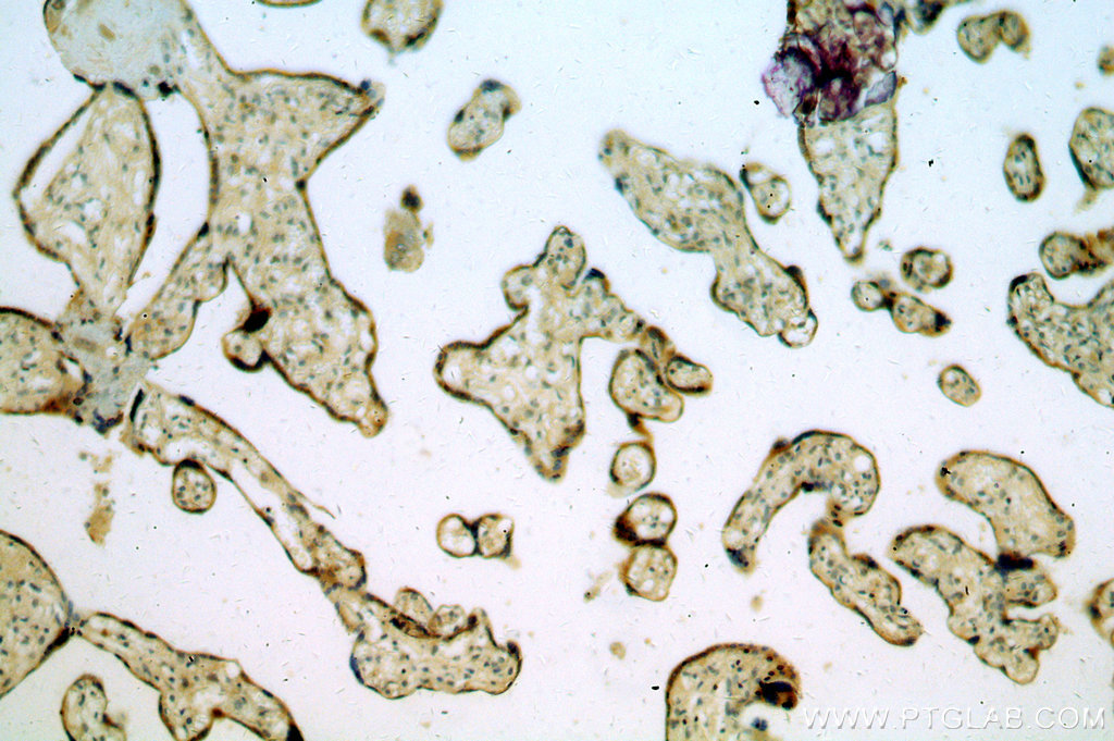 15598-1-AP;H-placenta