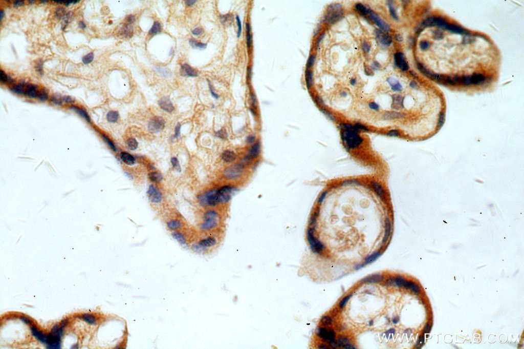 15598-1-AP;H-placenta