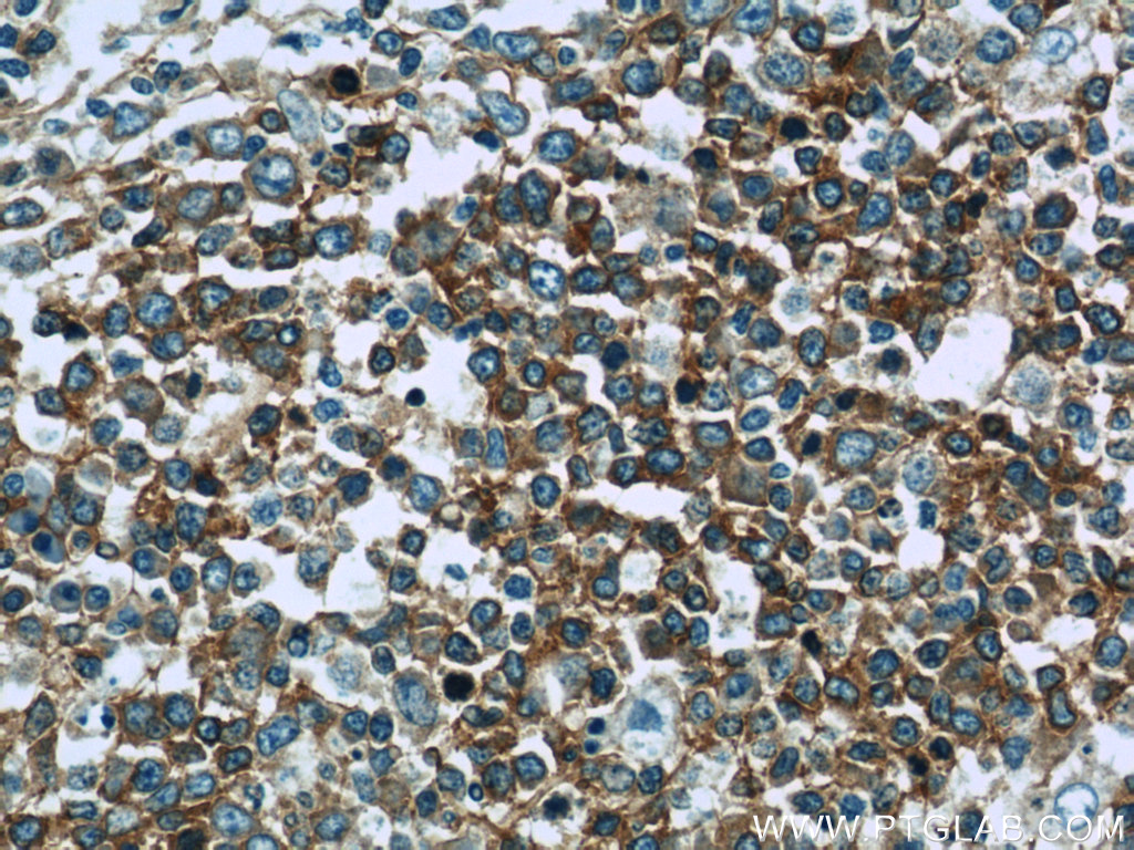 24289-1-AP;human tonsillitis tissue