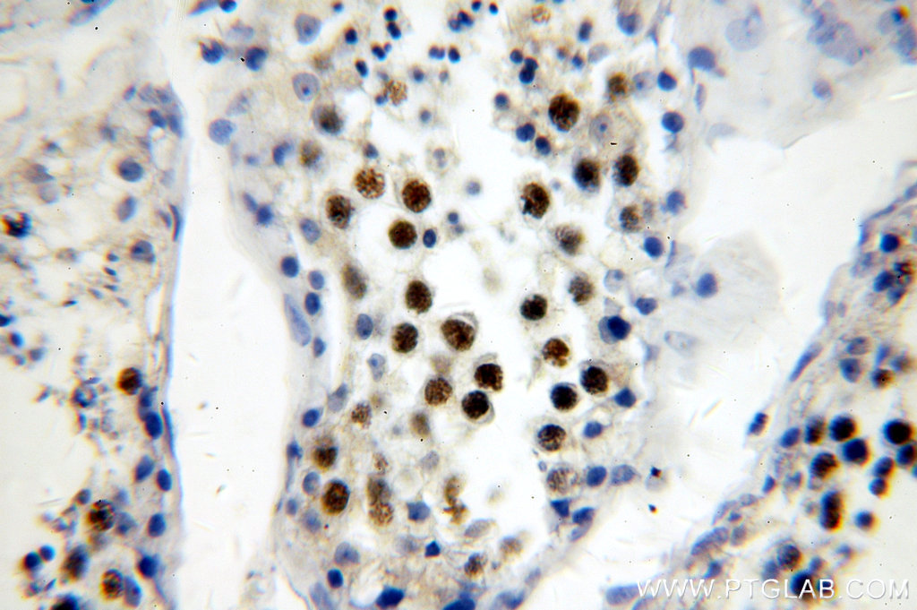 19893-1-AP;human testis