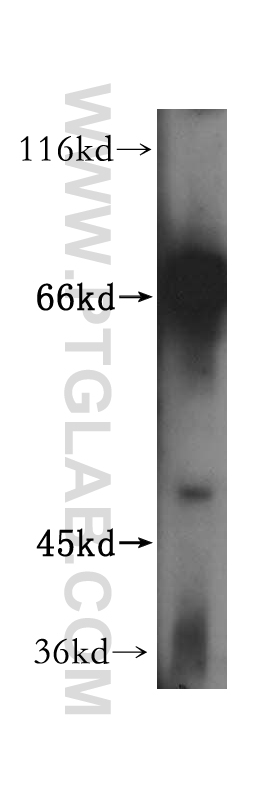 17222-1-AP;HeLa cell