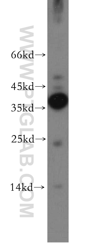 21394-1-AP;human brain tissue
