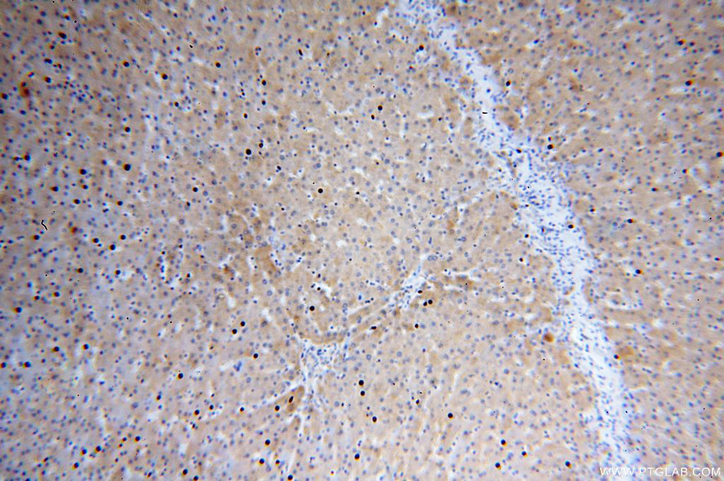 17203-1-AP;H-liver