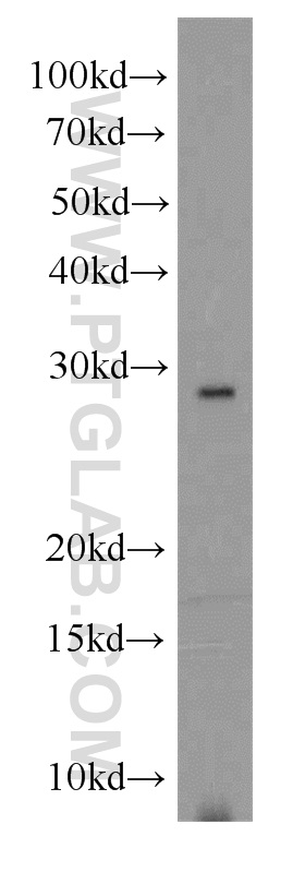 17203-1-AP;human testis tissue