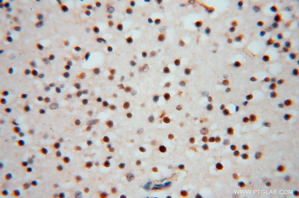 16518-1-AP;human brain
