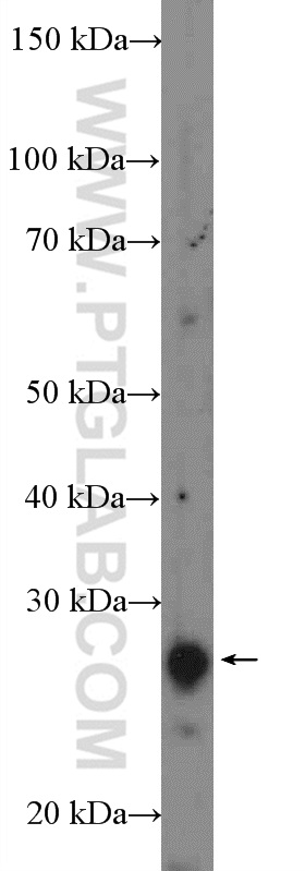 16832-1-AP;mouse brain tissue