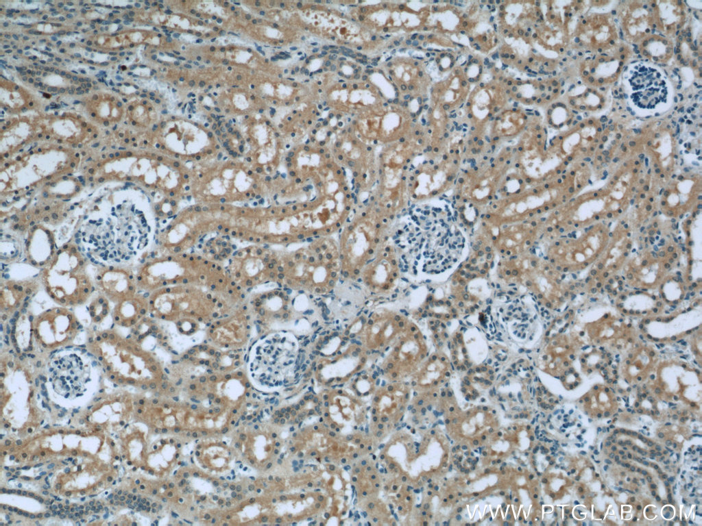 23762-1-AP;human kidney tissue