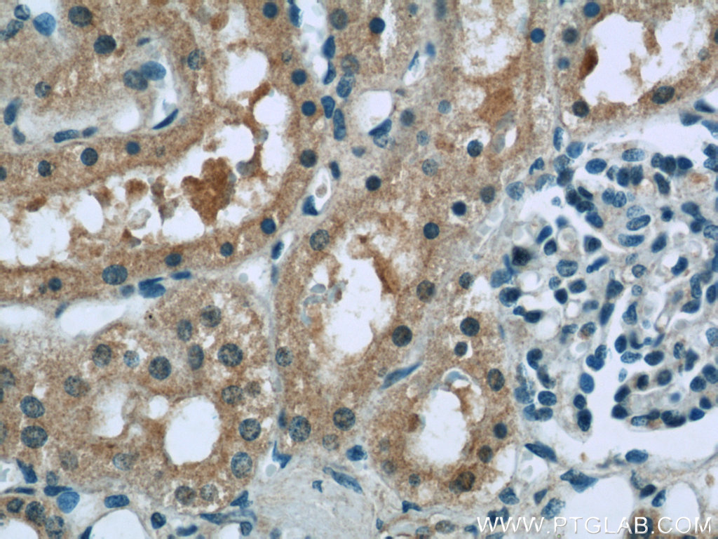 23762-1-AP;human kidney tissue
