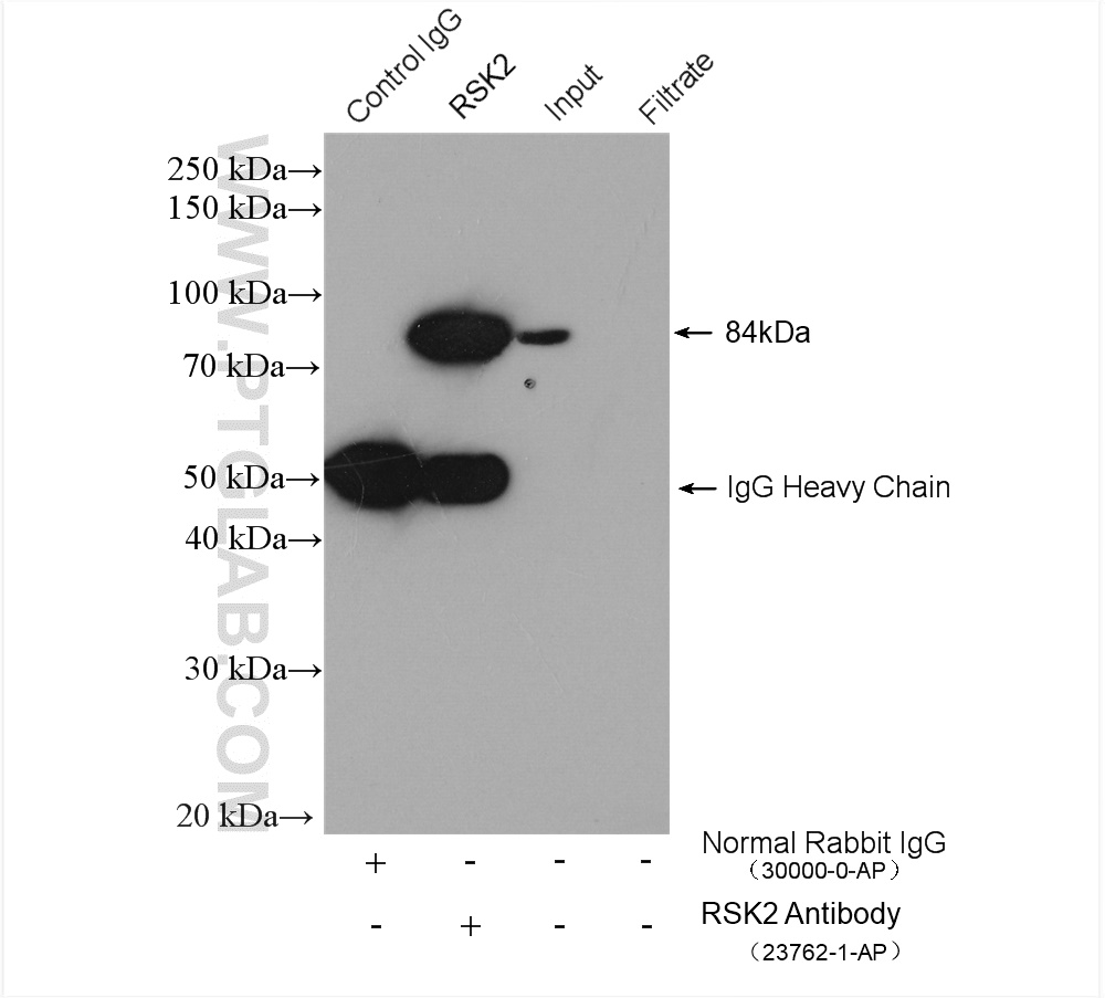 RSK2 Antibody 237621AP Proteintech