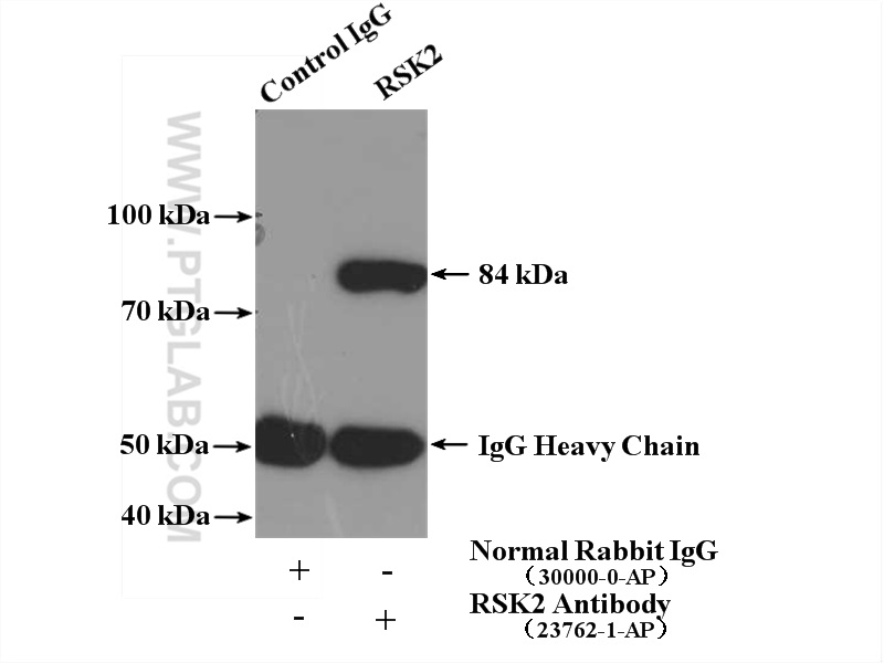 23762-1-AP;K-562 cells