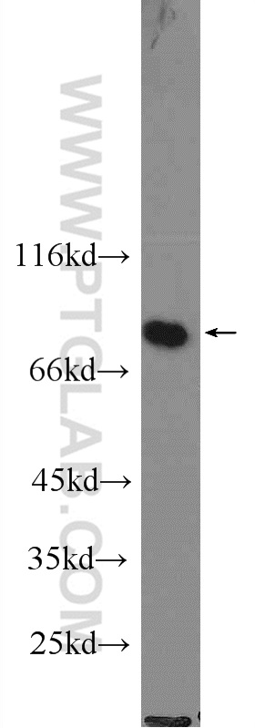 23762-1-AP;K-562 cells
