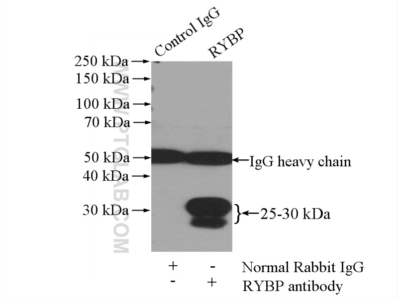 11365-1-AP;mouse spleen tissue