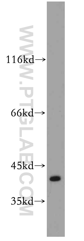 10229-1-AP;A431 cells