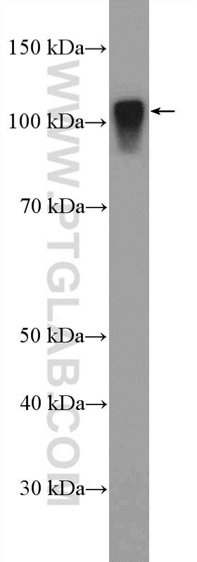 22762-1-AP;rat liver tissue