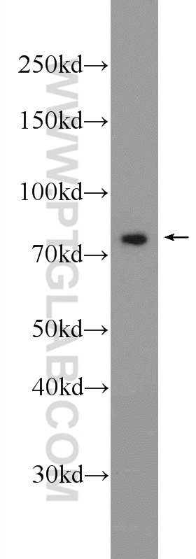 23911-1-AP;Jurkat cells