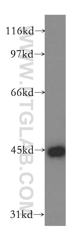13664-1-AP;Y79 cell
