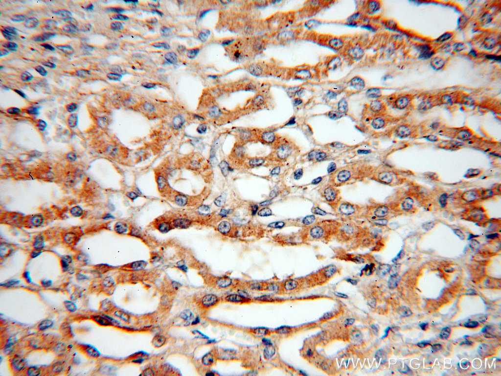 15422-1-AP;human kidney