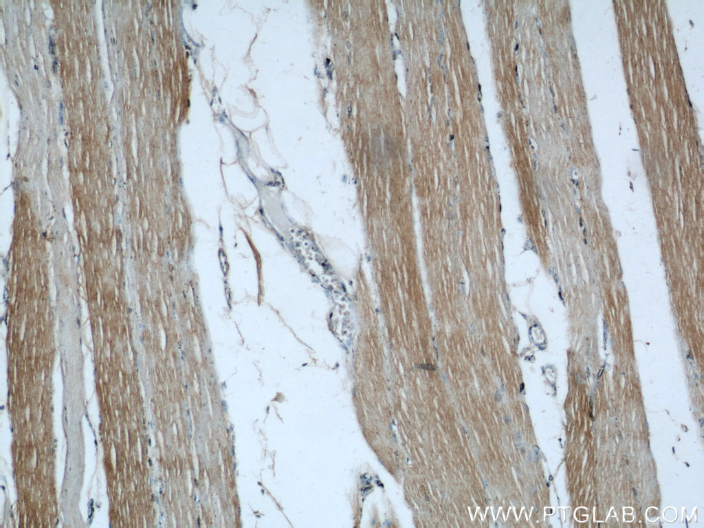 21909-1-AP;human skeletal muscle tissue