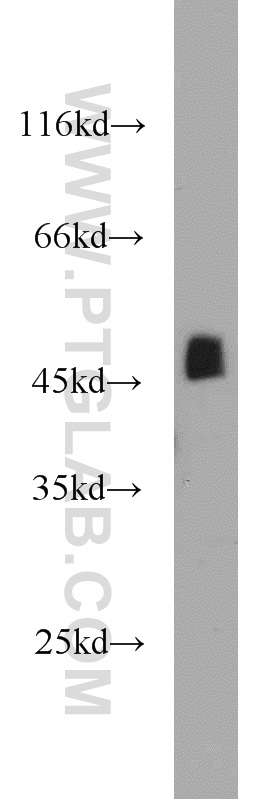 21909-1-AP;mouse skeletal muscle tissue