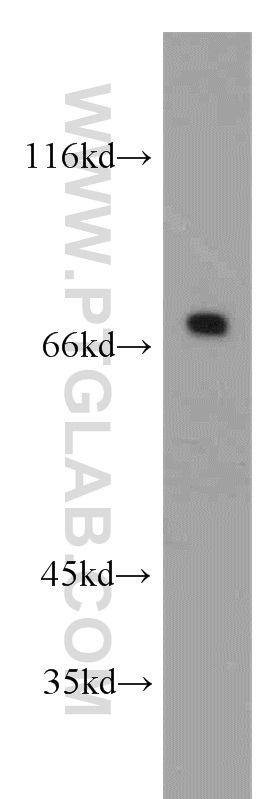 20302-1-AP;HEK-293 cell