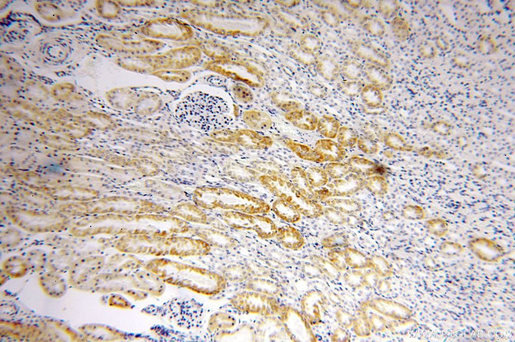 15235-1-AP;human kidney tissue