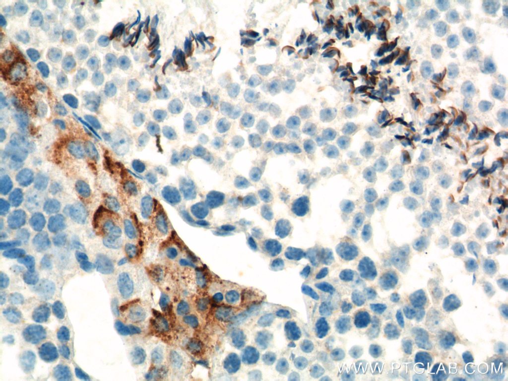 16342-1-AP;mouse testis tissue
