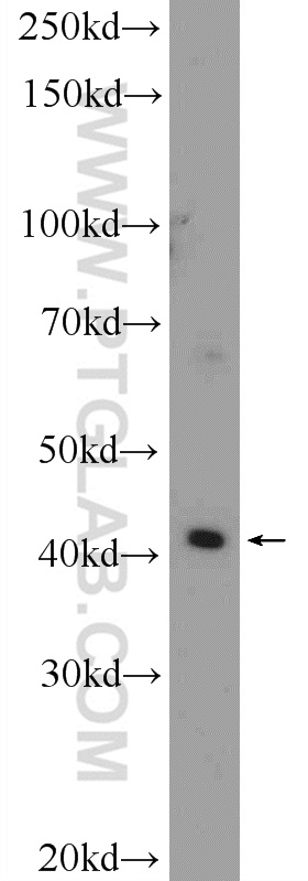 25526-1-AP;A549 cells