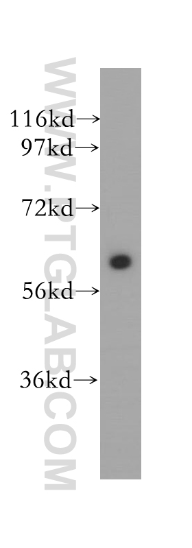 12039-1-AP;human brain tissue