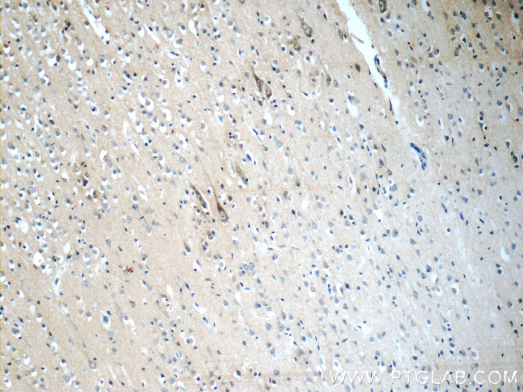 21848-1-AP;human brain tissue