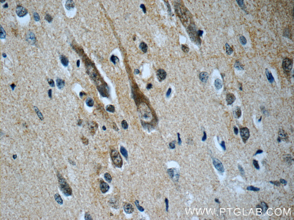 21848-1-AP;human brain tissue