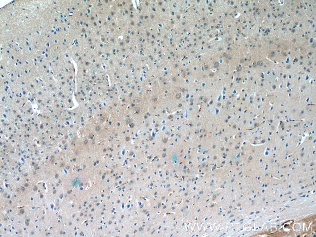 22524-1-AP;mouse brain tissue