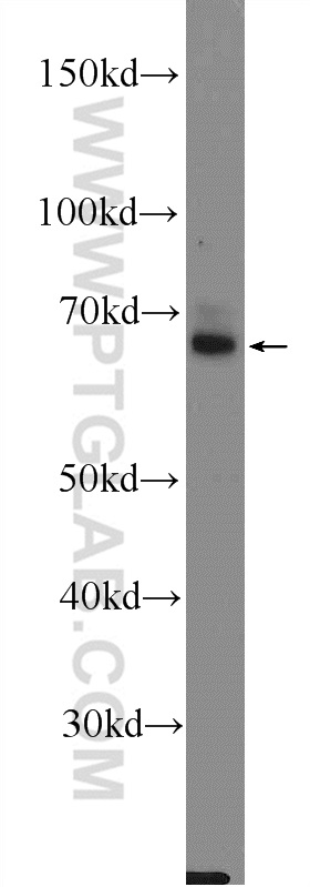 22524-1-AP;rat brain tissue