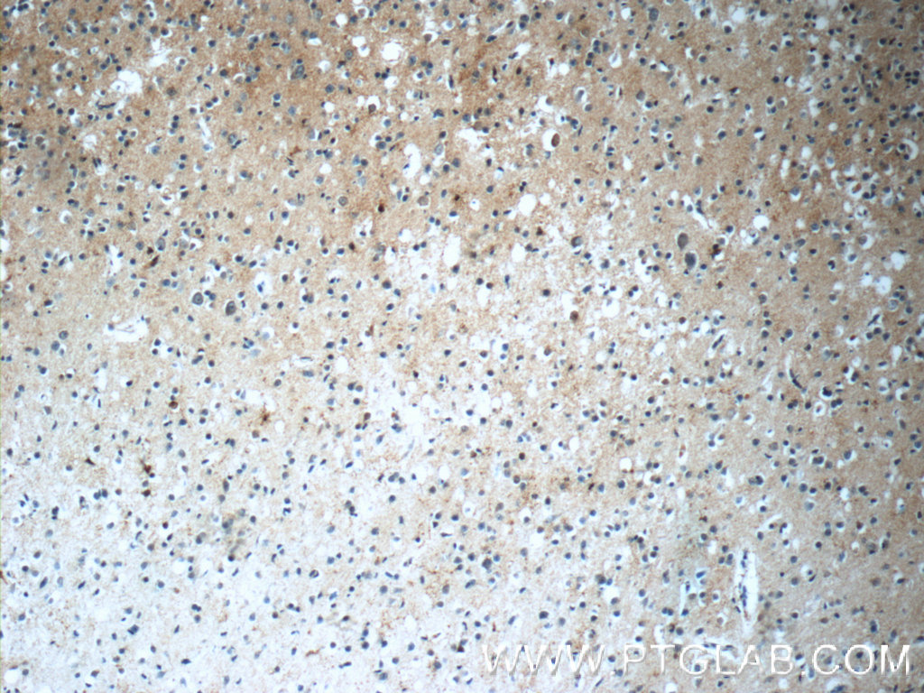 10275-1-AP;human brain tissue