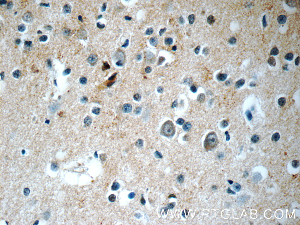 10275-1-AP;human brain tissue