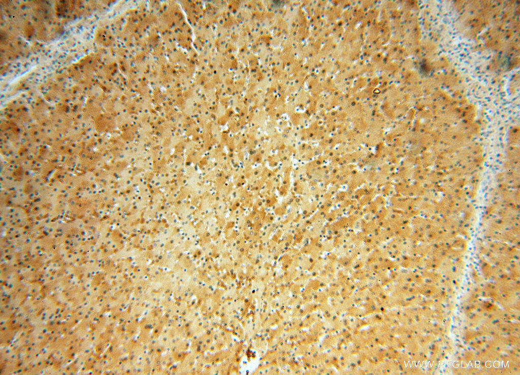 10269-1-AP;H-liver