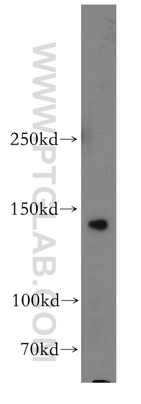 55063-1-AP;Jurkat cell