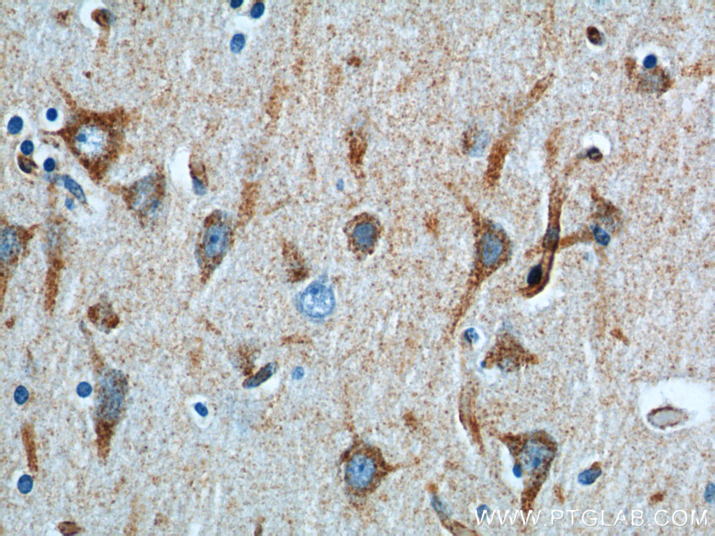 12369-1-AP;human brain tissue