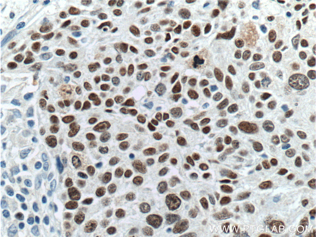 SOX2 Antibody 664111Ig Proteintech