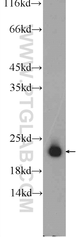 17072-1-AP;human testis tissue