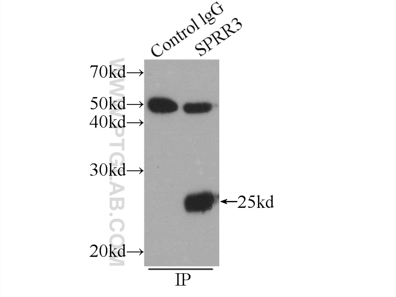 11742-1-AP;COLO 320 cells
