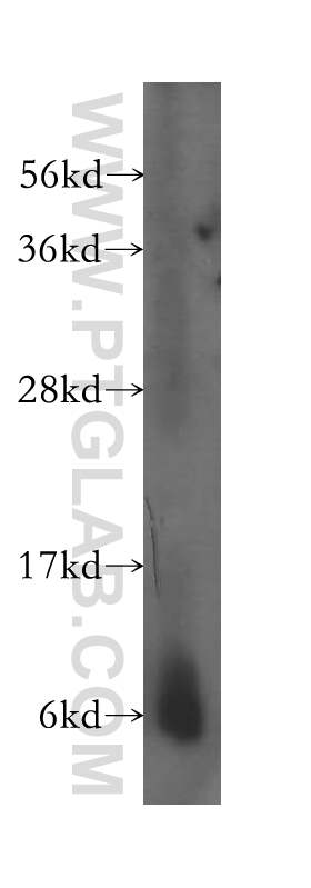 11817-1-AP;human liver tissue