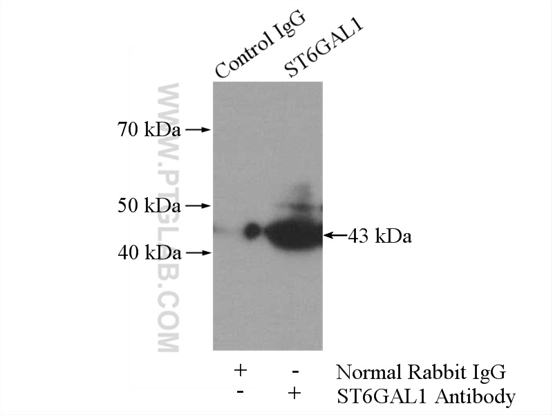 14355-1-AP;Raji cells